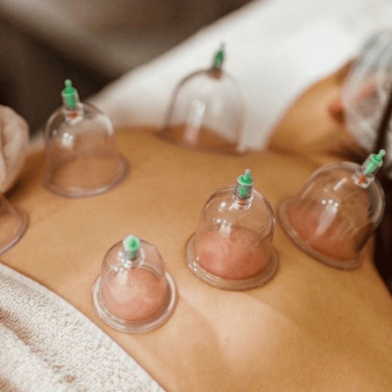 Ventosas com 12 Peças + Bomba para Ventosaterapia Kit