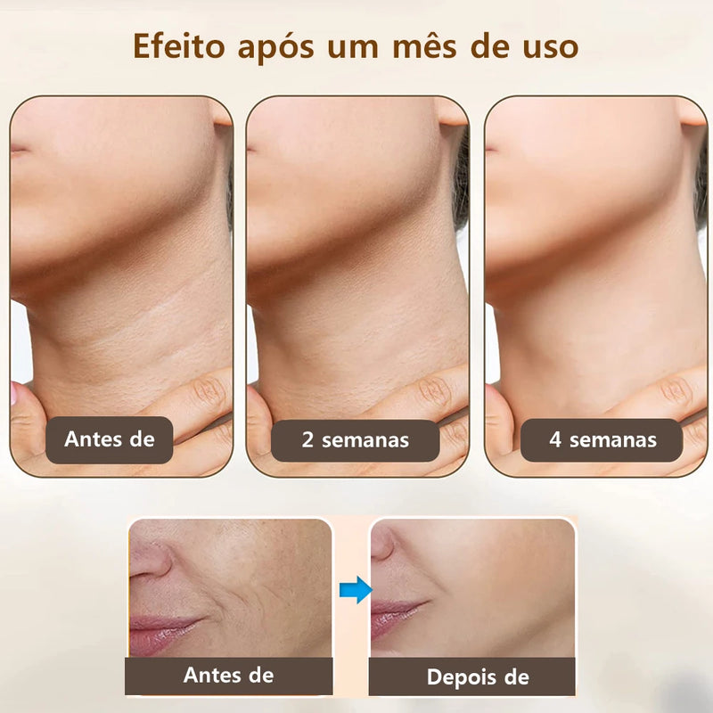 Antirugas - Massageador de rosto  e Pescoço,  possui Microrrentes elétricas com Terapia de luz .
